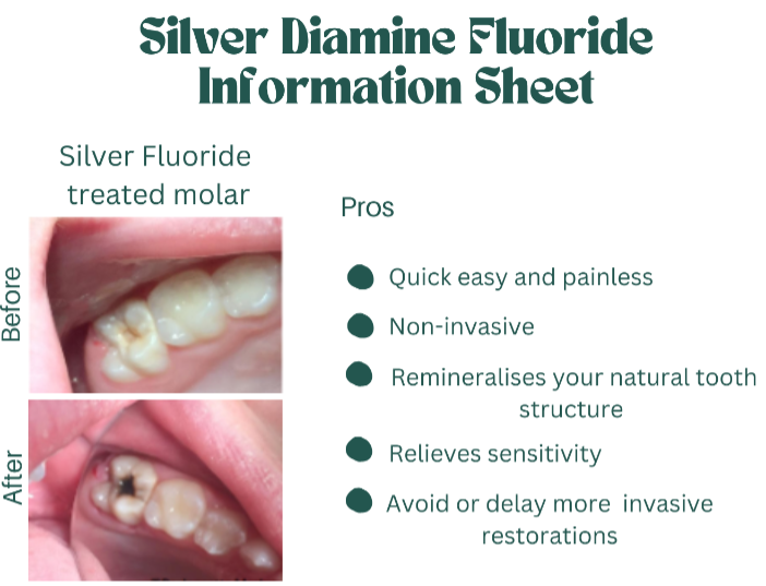 Silver Diamine Fluoride Information Sheet